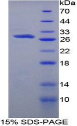 PROS1 / Protein S Protein - Recombinant Protein S By SDS-PAGE