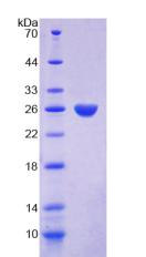 PRTN3 / Myeloblastin Protein - Recombinant Proteinase 3 By SDS-PAGE