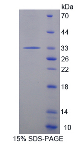 PTPRH / SAP-1 Protein - Recombinant  Protein Tyrosine Phosphatase Receptor Type H By SDS-PAGE