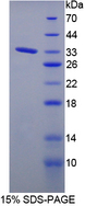 PTPRJ / CD148 Protein - Recombinant  Protein Tyrosine Phosphatase Receptor Type J By SDS-PAGE