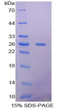 PTX3 / Pentraxin 3 Protein - Recombinant Pentraxin 3, Long By SDS-PAGE