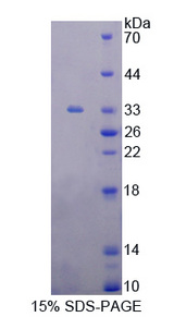 PVR / CD155 Protein - Recombinant  Poliovirus Receptor By SDS-PAGE