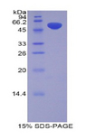 PZP Protein - Recombinant Pregnancy Zone Protein By SDS-PAGE