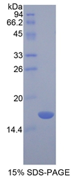 RARRES2 / Chemerin Protein - Recombinant Chemerin By SDS-PAGE