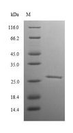 RB1 / Retinoblastoma / RB Protein - (Tris-Glycine gel) Discontinuous SDS-PAGE (reduced) with 5% enrichment gel and 15% separation gel.
