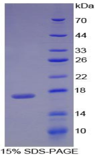 RBP1 / CRBP Protein - Recombinant Retinol Binding Protein 1, Cellular By SDS-PAGE