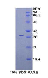 RBP3 / IRBP Protein - Recombinant Retinol Binding Protein 3, Interstitial By SDS-PAGE