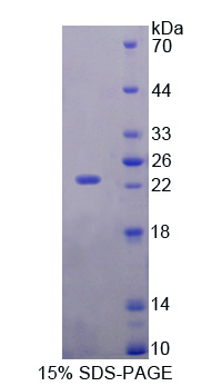 RBP5 Protein - Recombinant Retinol Binding Protein 5, Cellular By SDS-PAGE