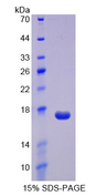 REG3A Protein - Recombinant  Regenerating Islet Derived Protein 3 Alpha By SDS-PAGE