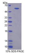 RGS6 Protein - Recombinant Regulator Of G Protein Signaling 6 By SDS-PAGE
