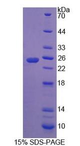 RHAG Protein - Recombinant Rh Associated Glycoprotein (RHAG) by SDS-PAGE