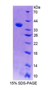 RNASEH2A Protein - Recombinant Ribonuclease H2 Subunit A (RNASEH2A) by SDS-PAGE