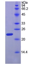 RPP40 / Ribonuclease P Protein - Active Ribonuclease P (RNASEP) by SDS-PAGE