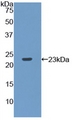 RPP40 / Ribonuclease P Protein - Active Ribonuclease P (RNASEP) by WB