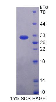 RTKN / Rhotekin Protein - Recombinant Rhotekin By SDS-PAGE