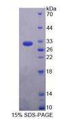 RTKN / Rhotekin Protein - Recombinant Rhotekin By SDS-PAGE