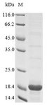 S100A4 / FSP1 Protein - (Tris-Glycine gel) Discontinuous SDS-PAGE (reduced) with 5% enrichment gel and 15% separation gel.
