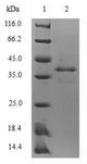 S100A9 / MRP14 Protein - (Tris-Glycine gel) Discontinuous SDS-PAGE (reduced) with 5% enrichment gel and 15% separation gel.