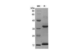S100A9 / MRP14 Protein - Recombinant Rat S100A9 Protein (His Tag)-Elabscience