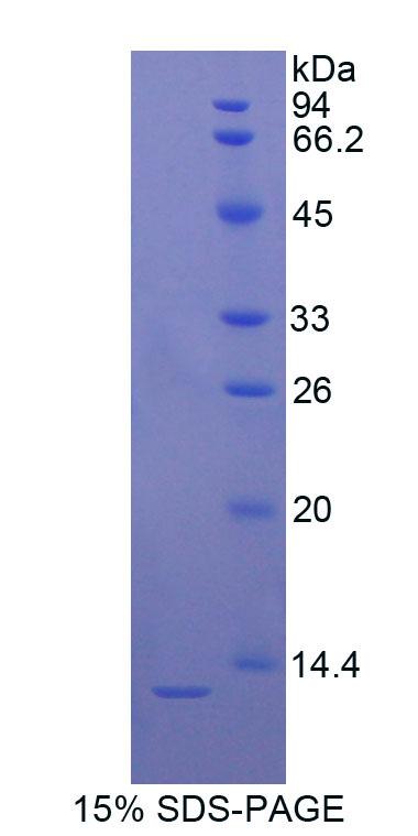 S100B / S100 Beta Protein - Recombinant S100 Calcium Binding Protein B By SDS-PAGE