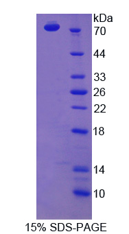 SCARB1 / SR-BI Protein - Recombinant Scavenger Receptor Class B Member 1 By SDS-PAGE
