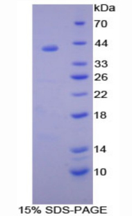SDC1 / Syndecan 1 / CD138 Protein - Recombinant Syndecan 1 By SDS-PAGE