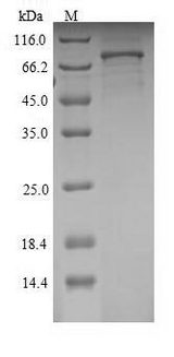 SEMA3A / Semaphorin 3A Protein - (Tris-Glycine gel) Discontinuous SDS-PAGE (reduced) with 5% enrichment gel and 15% separation gel.