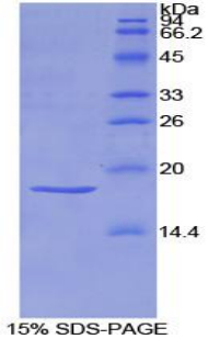 SEMA3A / Semaphorin 3A Protein - Recombinant Semaphorin 3A By SDS-PAGE