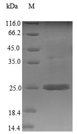 SERPINA1 / Alpha 1 Antitrypsin Protein - (Tris-Glycine gel) Discontinuous SDS-PAGE (reduced) with 5% enrichment gel and 15% separation gel.