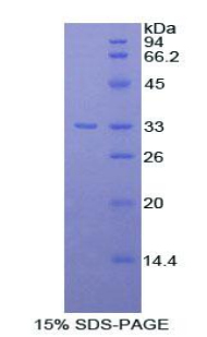 SERPINA7 / TBG Protein - Recombinant Thyroxine Binding Globulin By SDS-PAGE