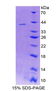 SERPINB1 Protein - Recombinant  Leukocyte Elastase Inhibitor By SDS-PAGE