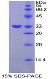 SERPINB2 / PAI-2 Protein - Recombinant Plasminogen Activator Inhibitor 2 By SDS-PAGE