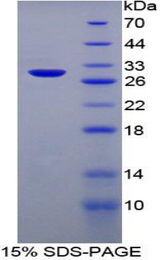 SERPIND1 / Heparin Cofactor 2 Protein - Recombinant Heparin Cofactor II By SDS-PAGE