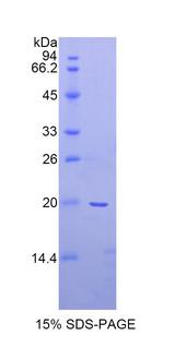 SERPINF2 / Alpha-2-Antiplasmin Protein - Recombinant Alpha-2-Plasmin Inhibitor By SDS-PAGE