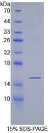 SFRP5 Protein - Recombinant Secreted Frizzled Related Protein 5 By SDS-PAGE