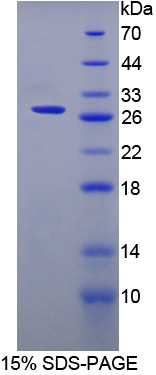 SFTPA2 / Surfactant Protein A2 Protein - Recombinant  Surfactant Associated Protein A2 By SDS-PAGE