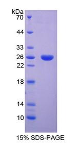 SFTPB / Surfactant Protein B Protein - Recombinant Surfactant Associated Protein B By SDS-PAGE