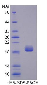 SHH / Sonic Hedgehog Protein - Recombinant Hedgehog Homolog, Sonic By SDS-PAGE