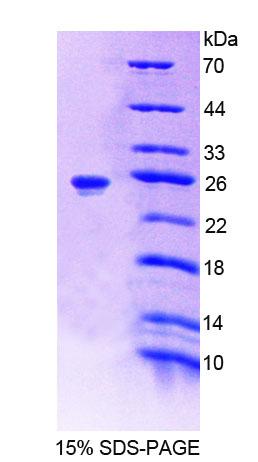 SHH / Sonic Hedgehog Protein - Recombinant Hedgehog Homolog, Sonic By SDS-PAGE