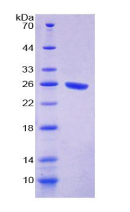 SIRPA / CD172a Protein - Recombinant  Signal Regulatory Protein Alpha By SDS-PAGE
