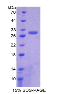 SIRT1 / Sirtuin 1 Protein - Recombinant Sirtuin 1 By SDS-PAGE
