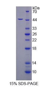 SKAP1 / SCAP1 Protein - Recombinant Src Kinase Associated Phosphoprotein 1 (SKAP1) by SDS-PAGE