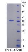 SLAMF1 / SLAM / CD150 Protein - Recombinant  Signaling Lymphocytic Activation Molecule Family, Member 1 By SDS-PAGE