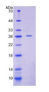 SLC25A20 / CACT Protein - Recombinant Carnitine Acylcarnitine Translocase By SDS-PAGE