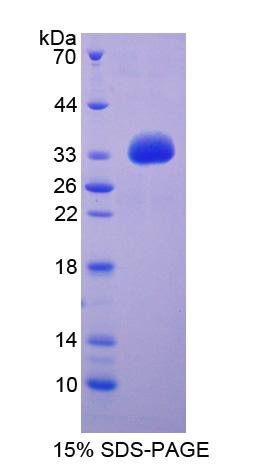 SLC27A1 / FATP Protein - Recombinant  Fatty Acid Transport Protein 1 By SDS-PAGE