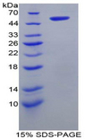 SLC27A5 / BACS Protein - Recombinant Fatty Acid Transport Protein 5 By SDS-PAGE