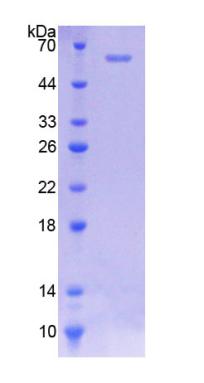 SLC38A1 / NaT2 Protein - Recombinant  N-Acetyltransferase 2 By SDS-PAGE