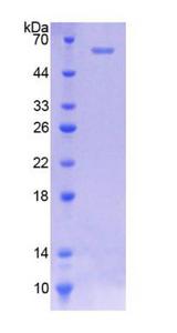 SLC38A1 / NaT2 Protein - Recombinant  N-Acetyltransferase 2 By SDS-PAGE