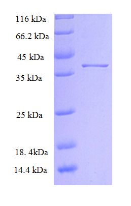 SLC39A13 / ZIP13 Protein