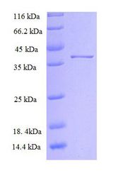 SLC39A13 / ZIP13 Protein